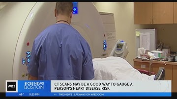 CT scan may be better at predicting heart disease than genetics, report says