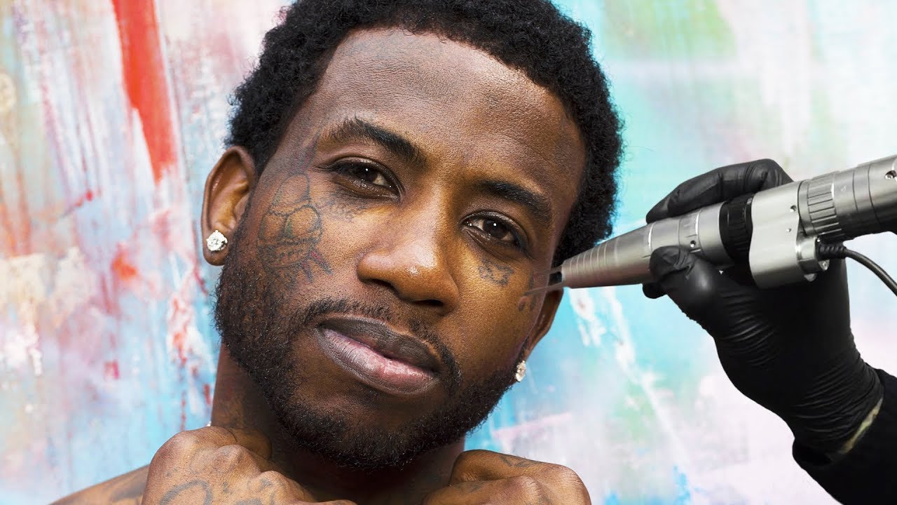 Removing GUCCI MANE'S Face Tattoos - YouTube