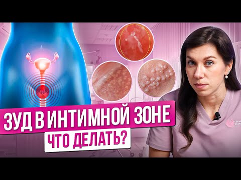 Зуд половых губ и влагалища. Как избавиться от зуда в интимной зоне у женщины Как снять зуд с вульвы