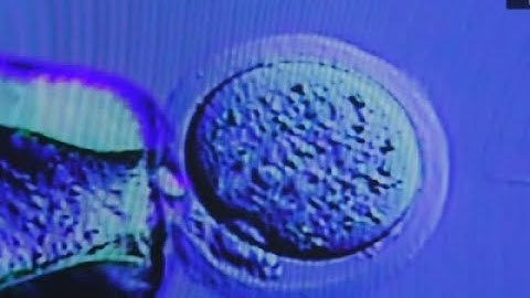 Scientists Edit Human Embryo Genes in US First