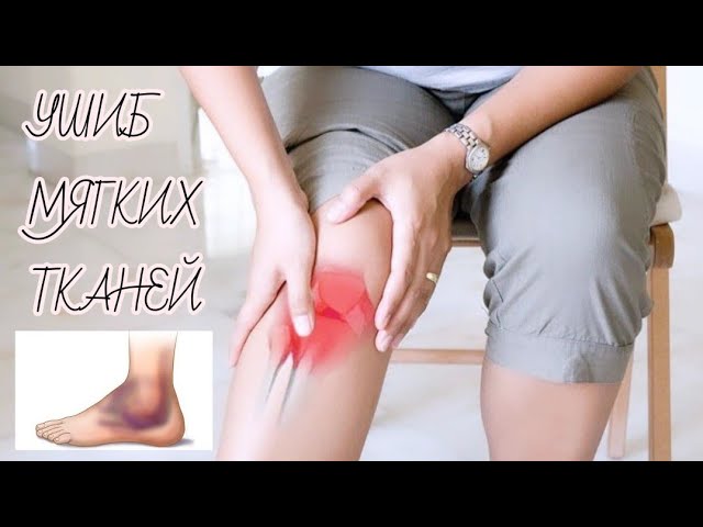 Ушиб мягких тканей | ушиб | травма