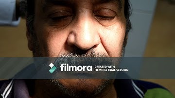 Clinical Complete denture 1 PRS 412n Denture Try in