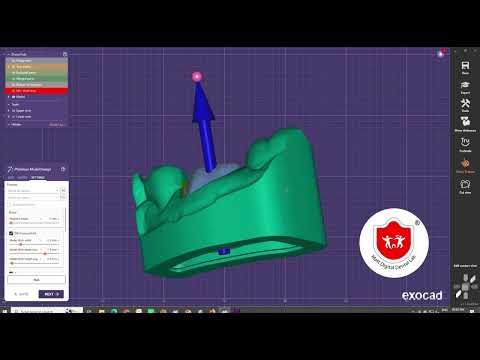 How to Create Ditched Models in Exocad | Complete Step-by-Step CAD CAM Dental Tutorial