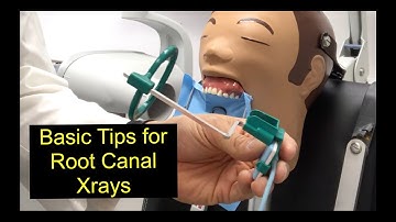 Basic Tips for Root Canal Xrays
