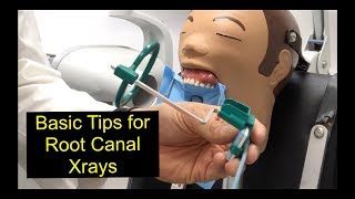 Basic Tips for Root Canal Xrays