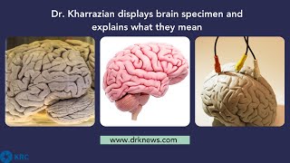 Video Thumbnail for Brain Health Video