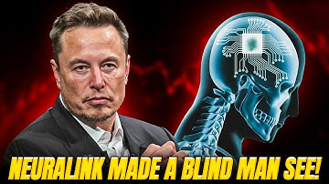 Elon Musk’s Neuralink Cures Blindness? Real-Life Test Shocks Scientists