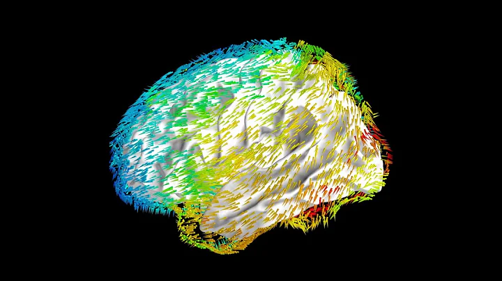 Traveling wave propagation in human brain