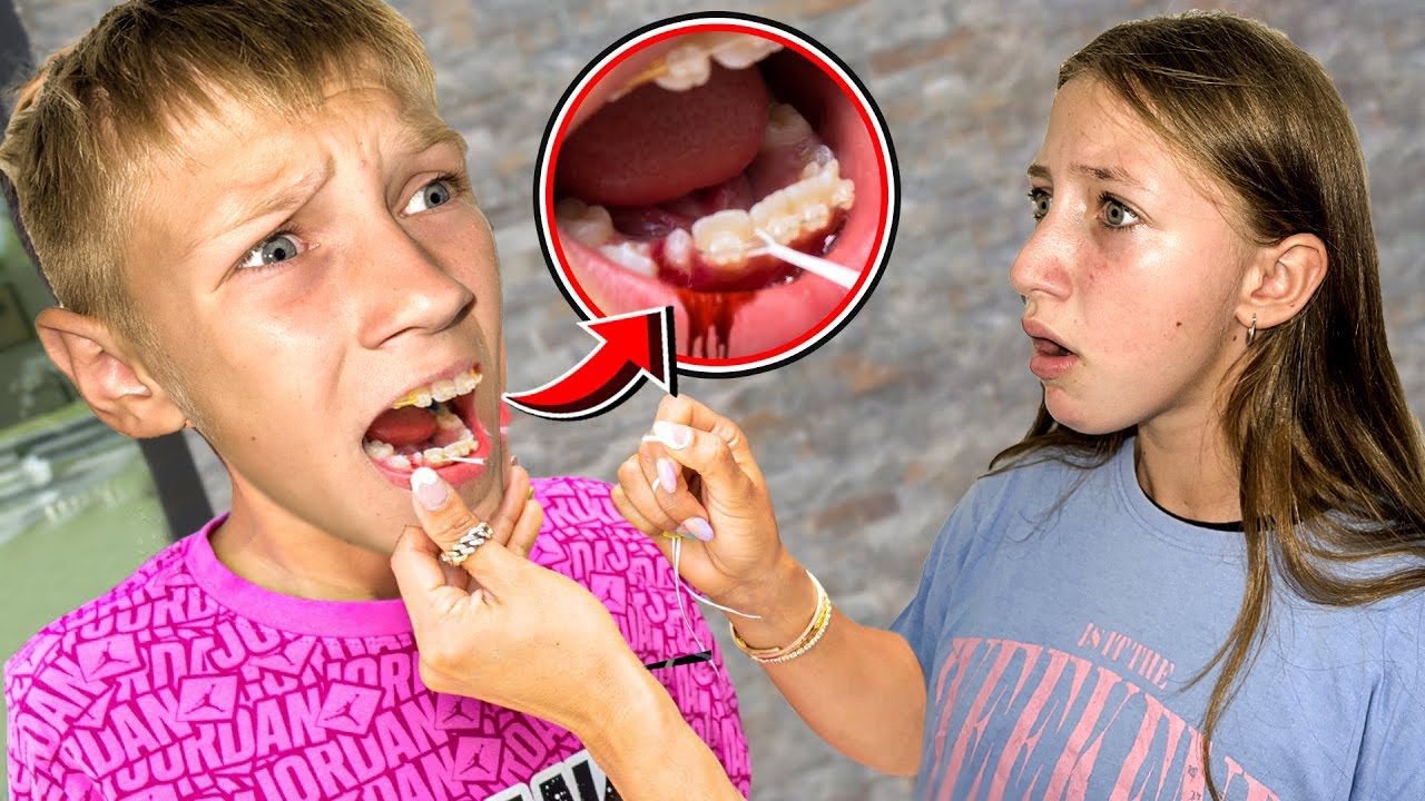 NE MOŽEMO DA VJERUJEMO DA JE ALENOV BRAT OVO URADIO ALENU !*uskoro box meč između Ernesta i Aldijana