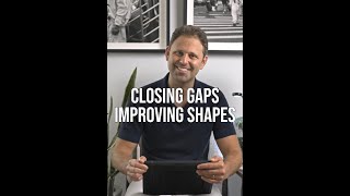 Closing Gaps Improving Shapes | Dental Science