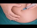 No Pain Injection Trick 😲 | IM Injection Easy Method