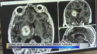 Study finds GammaTile lowers brain tumor regrowth rates