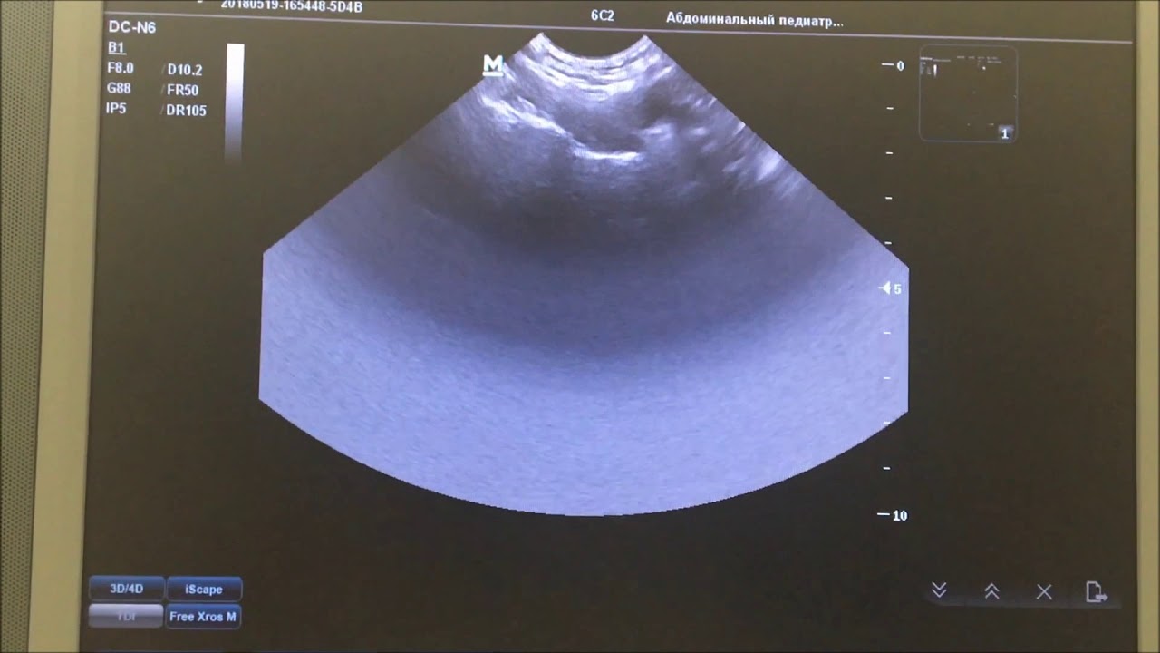 Настройка аппаратуры mindray