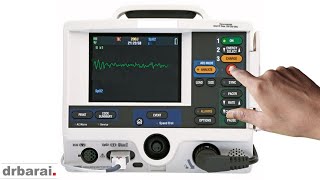 Cardiac arrest rhythms- All the ECG rhythms that you will ever need to know in arrest and periarrest