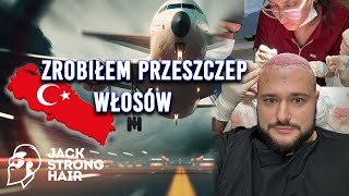 ZROBIŁEM PRZESZCZEP WŁOSÓW (Joker Vlog #1)