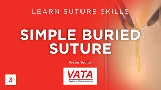 Simple Buried Suture - Learn Suture Techniques - VATA