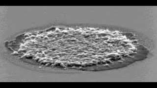 Synthesis, Characterization and Optimization of Electrophoretic Deposition EPD Parameters of YSZ