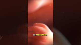 Download Lagu ICYMI: Moeder die abortusdruk trotseerde. #ChristianInfluence MP3 Download Lagu ICYMI: Moeder die abortusdruk trotseerde. #ChristianInfluence MP3