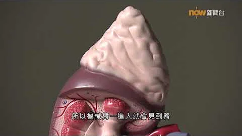 【杏林在线】不易察觉的肾癌 - 天天要闻