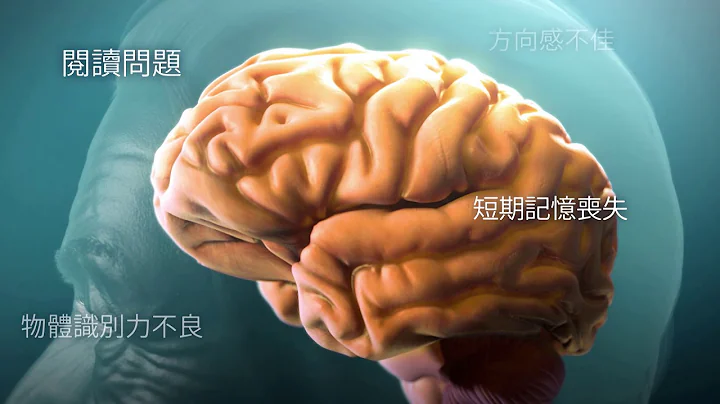 了解阿茲海默症 (Understanding Alzheimer's Disease) - 天天要聞