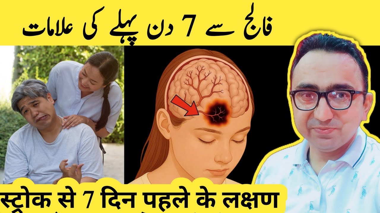 9 Early Signs of Stroke (It Shows 1 Week Before) | Symptoms Of Stroke