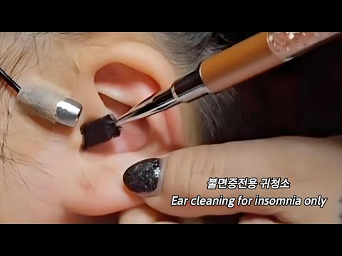 ASMR_ Real Series]  Ear cleaning for insomnia only_  不眠症専用耳掃除_  불면증전용 귀청소