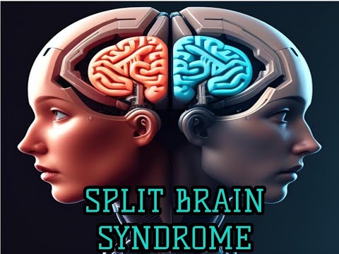 The Mysterious World Of Split Brain Syndrome #brain #medicine