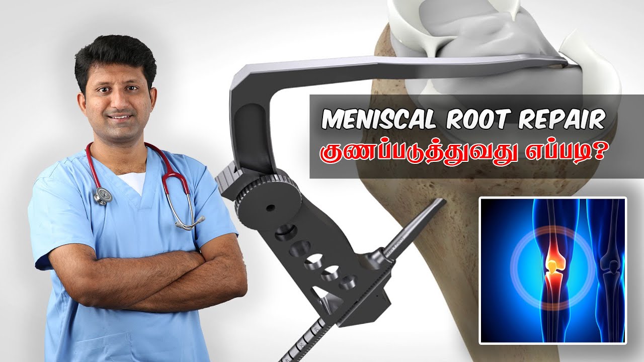 Meniscal Root Tear - மூட்டு ஜவ்வு கிழிதலுக்கான மருத்துவ தீர்வு | Dr Jeya Venkatesh