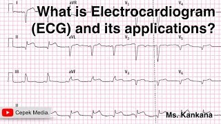 What is Electrocardiogram and it’s applications | Biotechnology | General Medicine screenshot 2