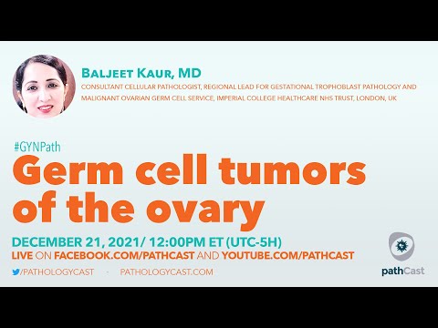 Germ Cell Tumors. of the Ovary