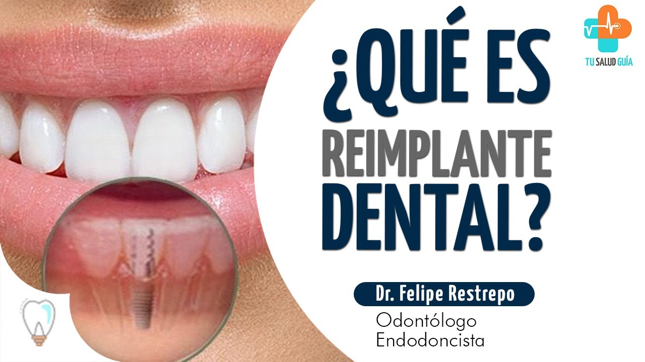 Que es una endodoncia dental y cuánto cuesta