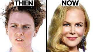 Nicole Kidman's NEW FACE | Plastic Surgery Analysis