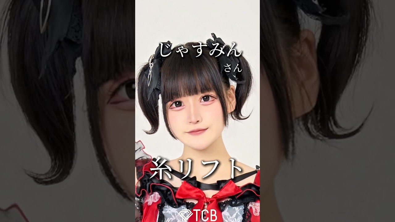 Thread lift] Will Jasmin revolutionize her facial contours