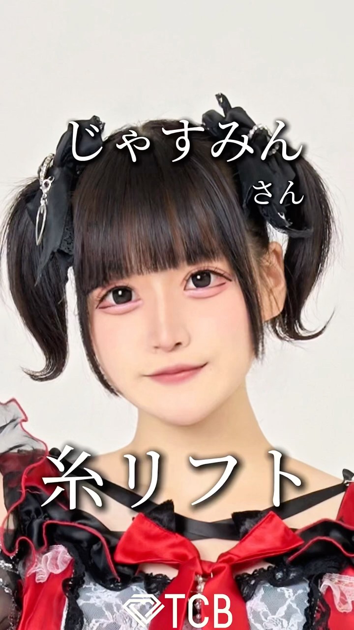 Thread lift] Will Jasmin revolutionize her facial contours