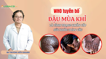 WHO tuyên bố đậu mùa khỉ là tình trạng khẩn cấp sức khỏe toàn cầu