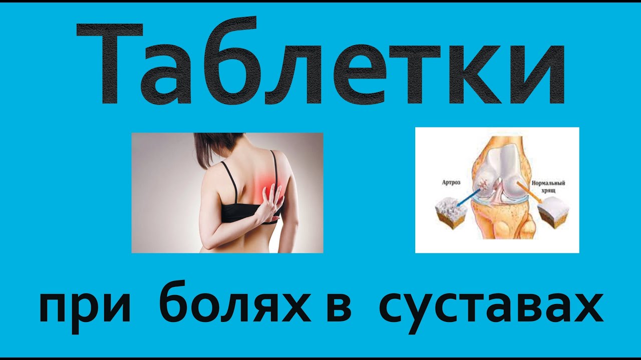 Врачи знают, какие таблетки нужны при болях в суставах и позвоночнике