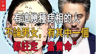 有這幾種痣相的人不論男女有其中一個註定“富貴命”