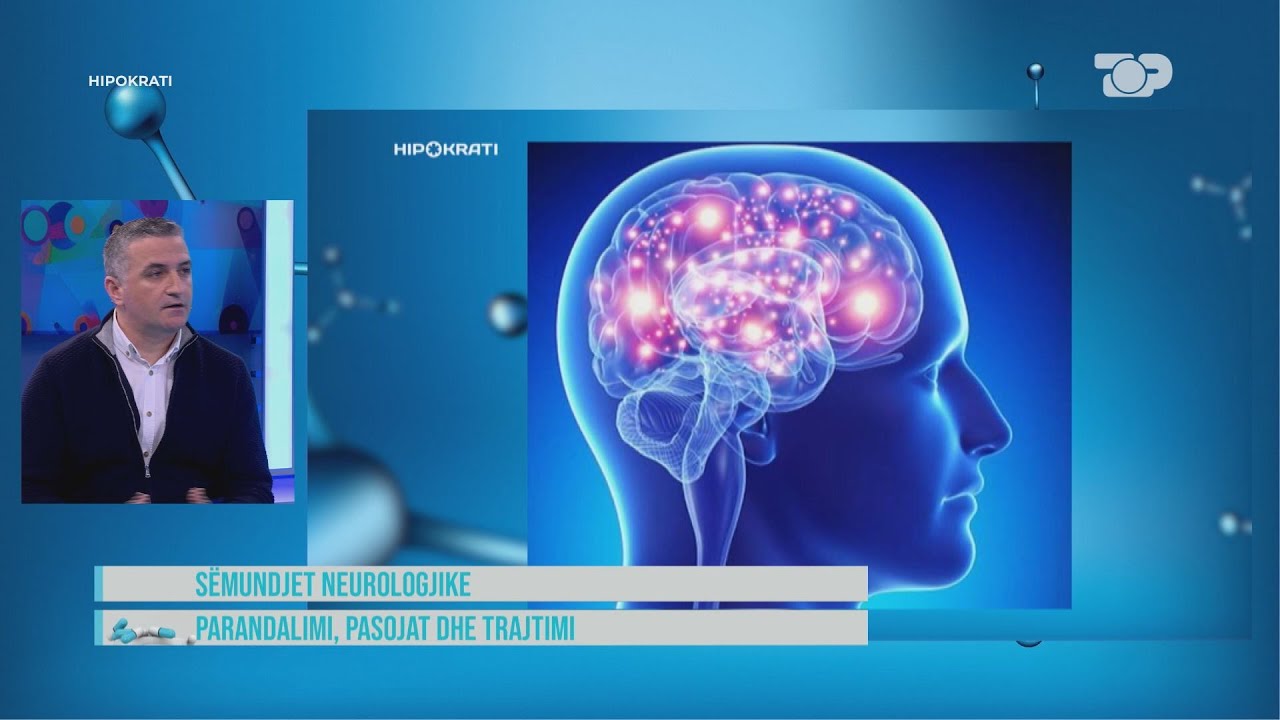 Goditja në tru, kujdes nësë keni këto shenja mund të paralizoheni! - Hipokrati