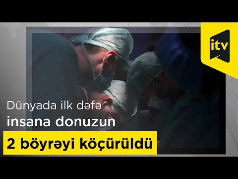 Video: Donuz böyrəyinin hilumunda hansı strukturlara rast gəlinir?