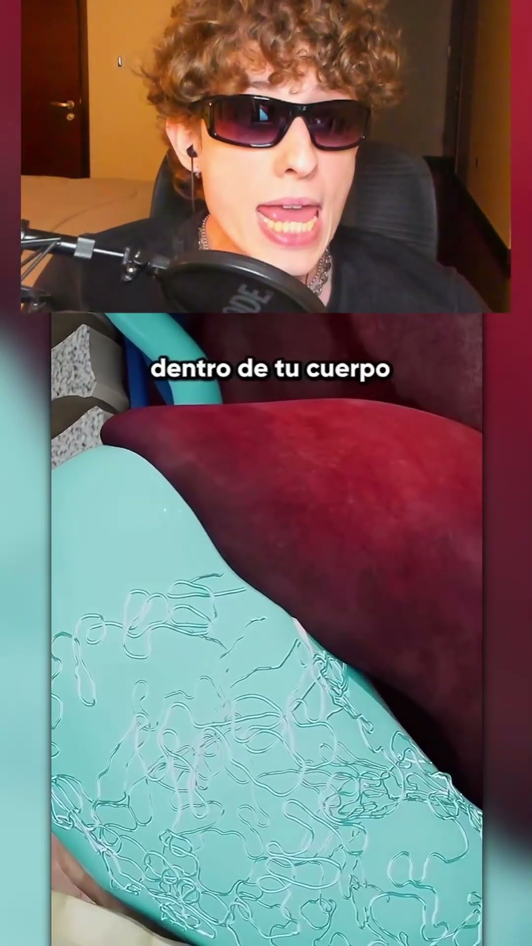 Qué es un GUSANO de GUINEA❓?