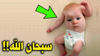 لن تصدق طفل يولد بدون وجة ورأس معجزة تهز العالم | سبحان الله !!