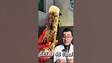 اقوى شامبو طبيعي اعمليه بنفسك 