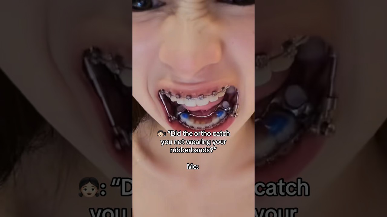 If you wearing braces rememeber to wear your rubber bands or you will get... 