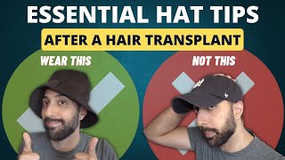 7 Essential Hat Tips AFTER a Hair Transplant