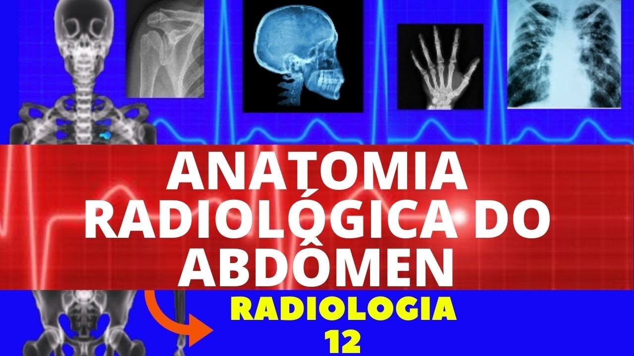 Radiologia: Abdômen simples