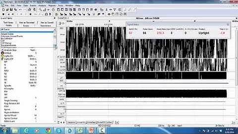 16. RemLogic Entering PAP Events During an Online Recording