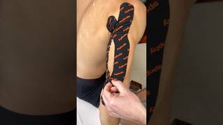 Inhibition of m. triceps brachii – a game-changing technique to release overstrained muscles.