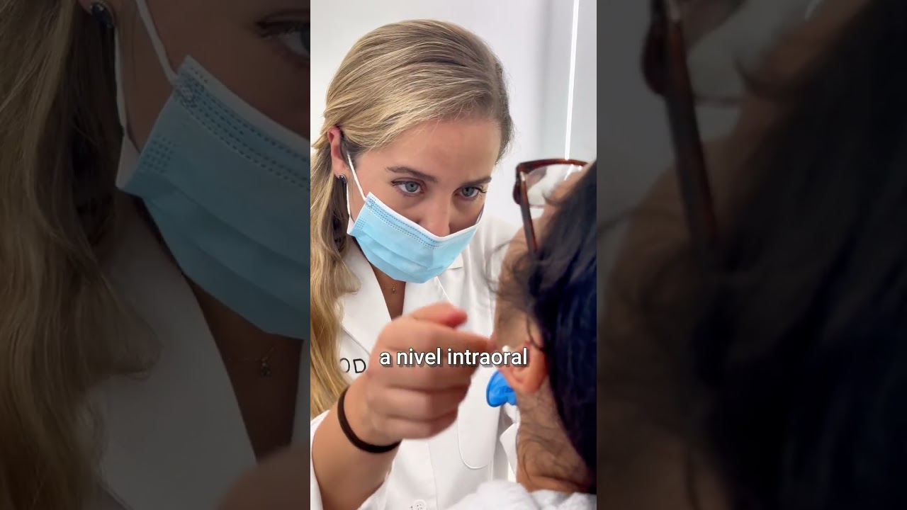 Efectividad de los alineadores invisibles en casos complejos de  maloclusiones - YouTube