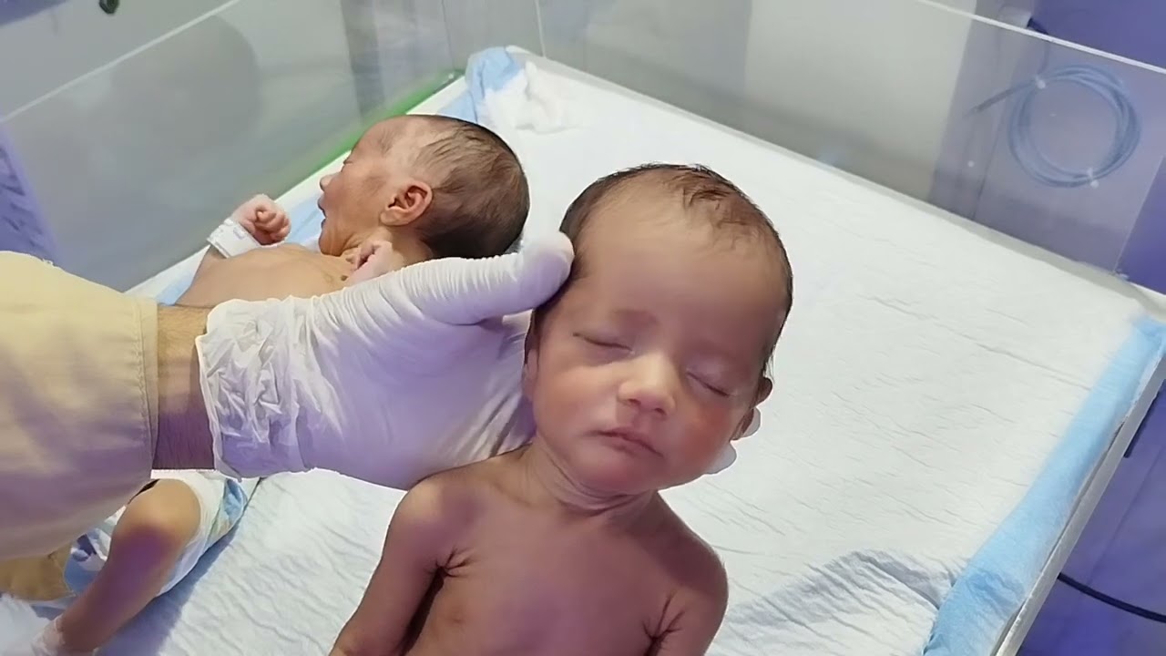 Twins Babies with HIE & RDS Start Bottle Feeding in NICU | A Beautiful Step Toward Recovery 👶🍼❤️ 