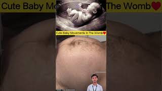 Cute Baby Movements In The Womb Educational Video